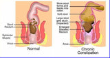 MIRACLE OXY-COLON CLEANSE 28 DAY COLON CLEANSER AND DETOX