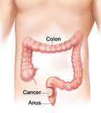 Colon Cleanser - Oxy-Cleanse - 3 Bottles - 80 Capsules Per Bottle.